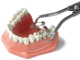 Walser Matrizenzange/Foto: Dr. Walser Dental GmbH
