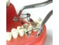 Matrizen Hersteller nimmt an größter Dentalmesse teil