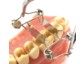Dr. Walser Dental: Sieger Deutscher Industriepreis 2013 mit Zahn-Matrize